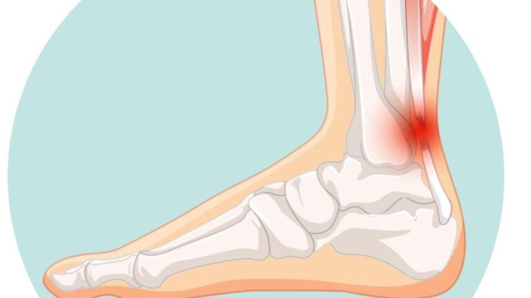 Is Heel Pain a Sign of Cancer?